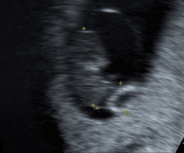 January 2021 due date- bus 3!