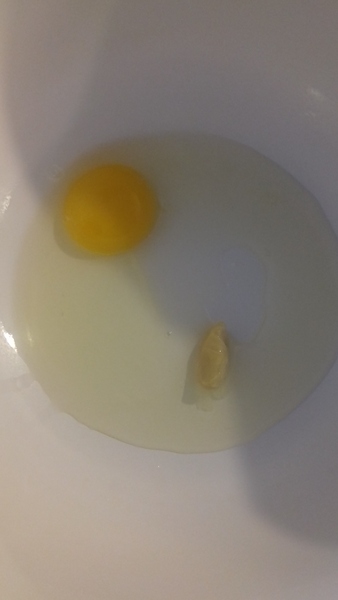 ...to be freaked out by this (gross photo included)