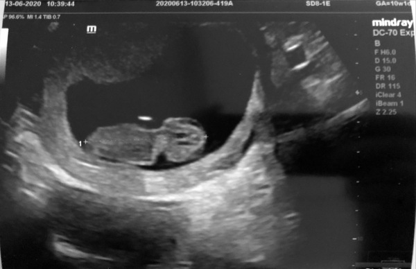 January 2021 due date- bus 3!