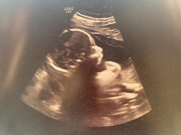 Am I having a boy or girl?