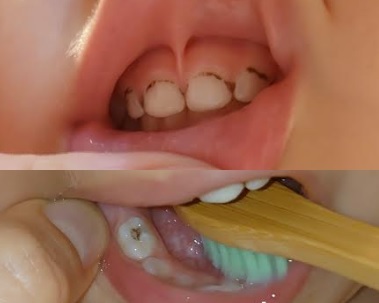 My toddler urgently needs dental care. I've been quoted 6k. Is this normal? London