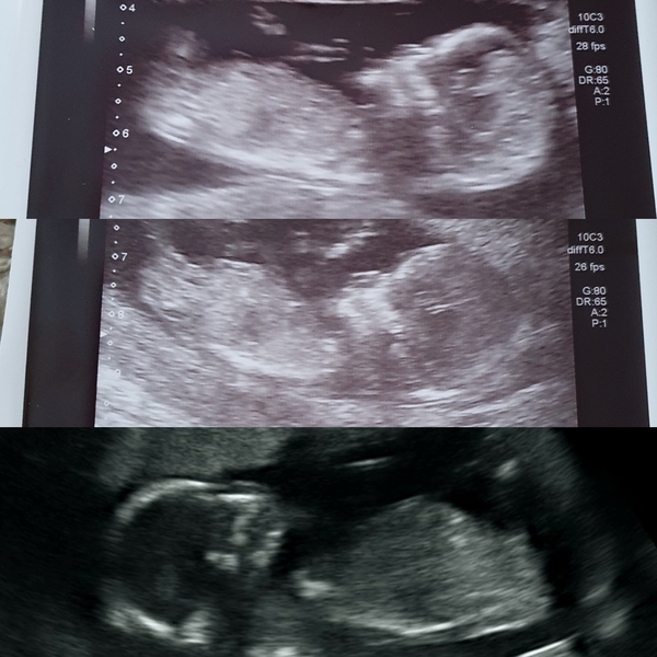 Just for fun... Boy or Girl ??