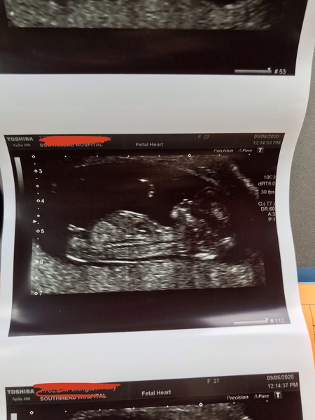 December 2020 babies thread #2