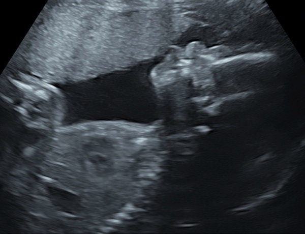 Pregnant After Loss and Dreaming of Rainbows - 4