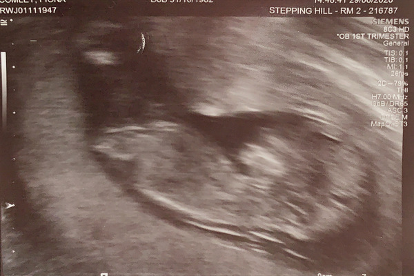 Catching up - TTC after miscarriage part 2