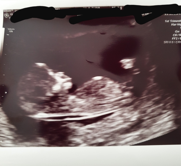 Christmas babies thread 3!