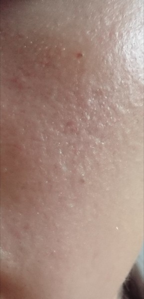 Why is my skin like this?