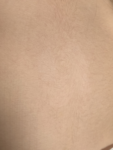 Light patch of skin