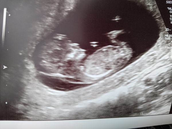 Jan/Feb 2021