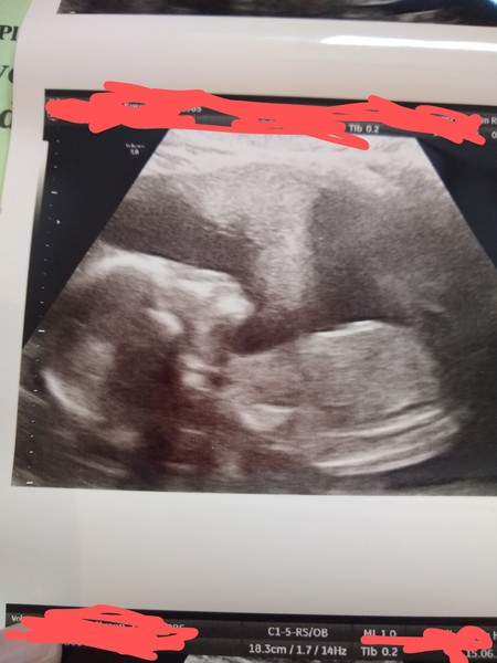 Any guesses?