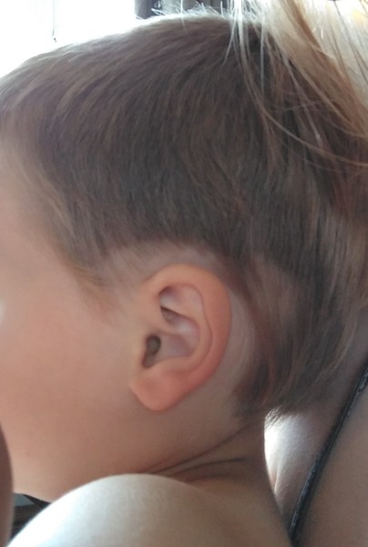 Is there anything I can do to rectify this hair