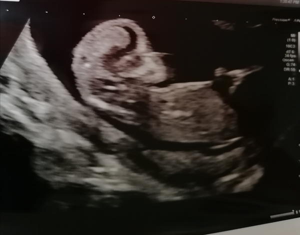 Christmas babies thread 3!