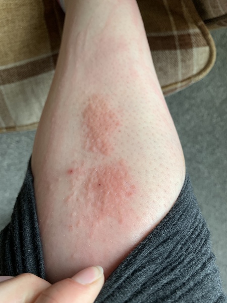 What is this?