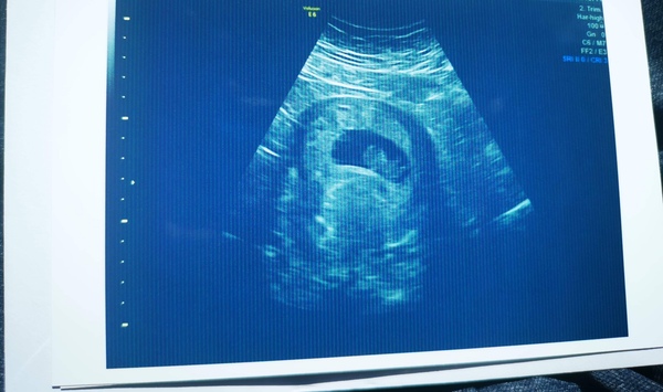 Due January - anyone else?