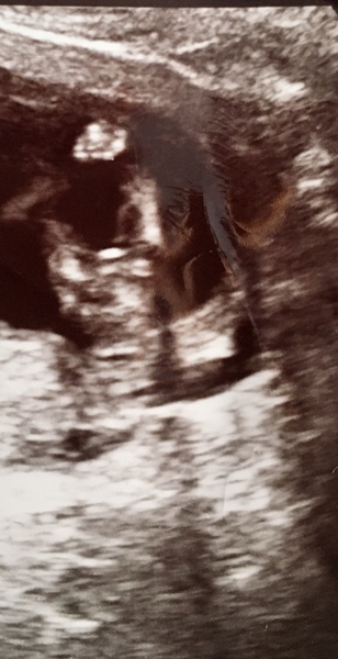 Anyone worried their private gender scan is wrong?