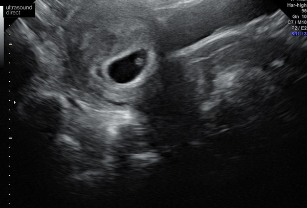 January 2021 due date- bus 3!
