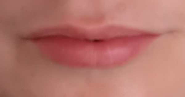 To think you can’t/tell if these lips have fillers? Photo attached