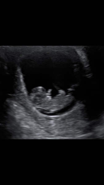 Christmas babies thread 3!