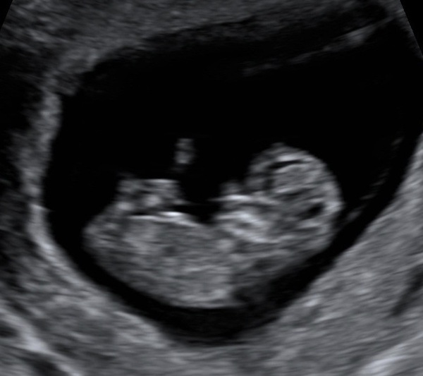Christmas babies thread 3!