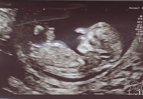Christmas babies thread 3!