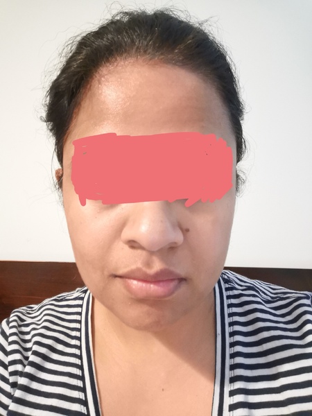 How do I add Vitamin C in my skincare (pic attached)