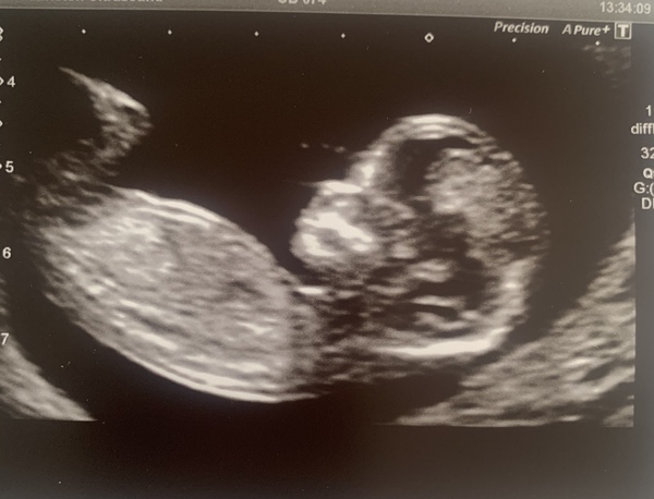 Christmas babies thread 3!