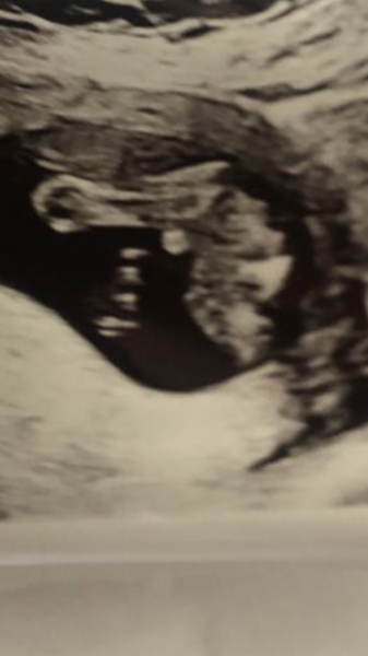 Boy or girl