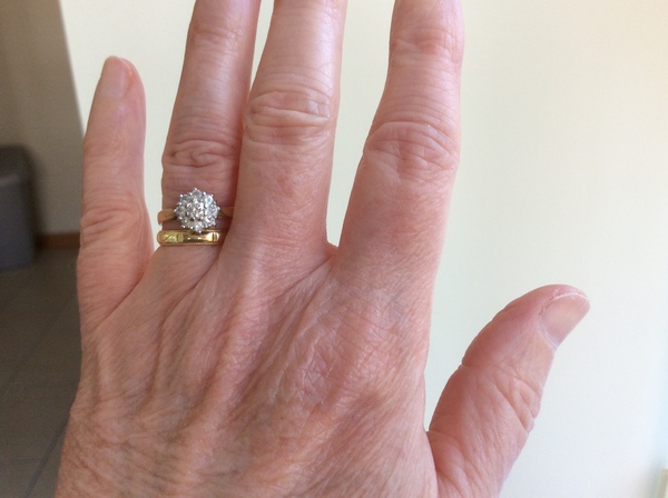 Show your Engagement rings!