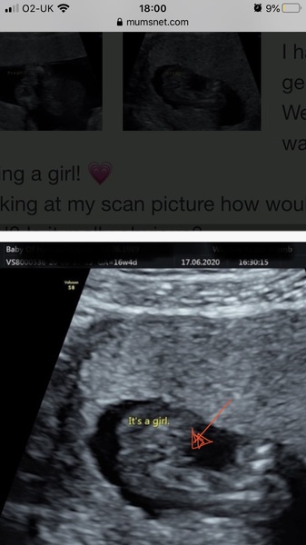 Private scan and gender