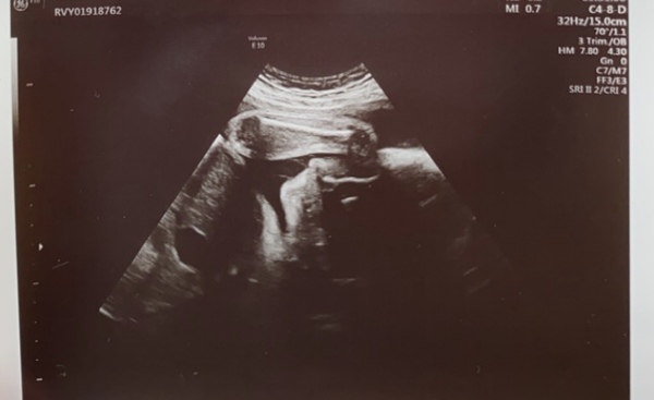 Due August 2020 Thread 2