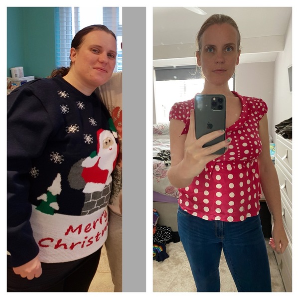 Contemplating bariatric surgery.... advice?