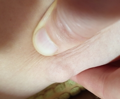 Lump on inner thing?