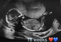 Boy or girl guesses? Scan pics attached