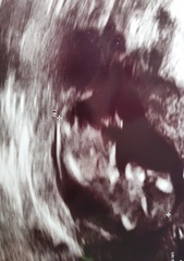 Gender Scan next week