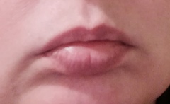 To think you can’t/tell if these lips have fillers? Photo attached