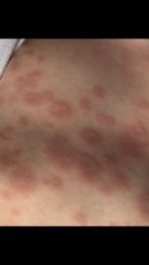 Let’s stop calling it ‘Kawasaki-like’ syndrome