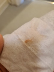 Could I be pregnant?