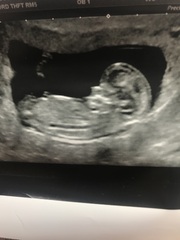 👣 Due late Nov/Dec, it's bump time ladies! 👣