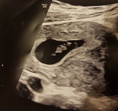How early for a reassurance / private scan?