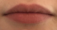 To feel sorry for woman who believe their lip fillers make them more attractive??