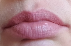 To think you can’t/tell if these lips have fillers? Photo attached