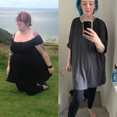 Contemplating bariatric surgery.... advice?