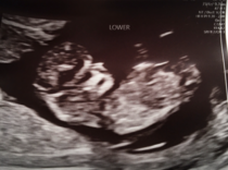 Identical twins gender guess - just for fun!