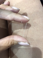 EWCM after Miscarriage - TMI post