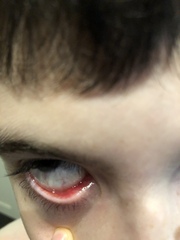 What’s wrong with ds’ eye? (With pics)