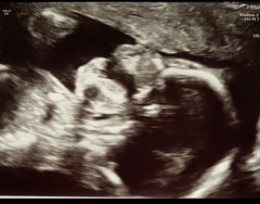 What do you think baby’s sex is?