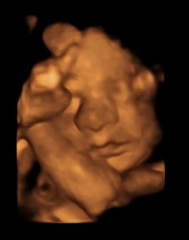 SHOW ME UR 4d SCANs