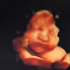 3d/4d scan with anterior placenta - worth it?