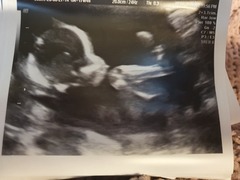 👣 Due late Nov/Dec, it's bump time ladies! 👣