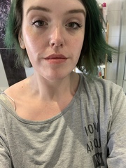 Contemplating bariatric surgery.... advice?
